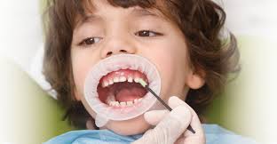 kids cavities